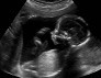 2d ultrasound icon