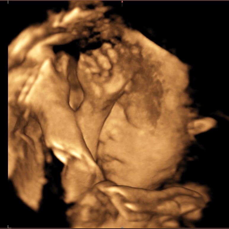 3d baby hand and face